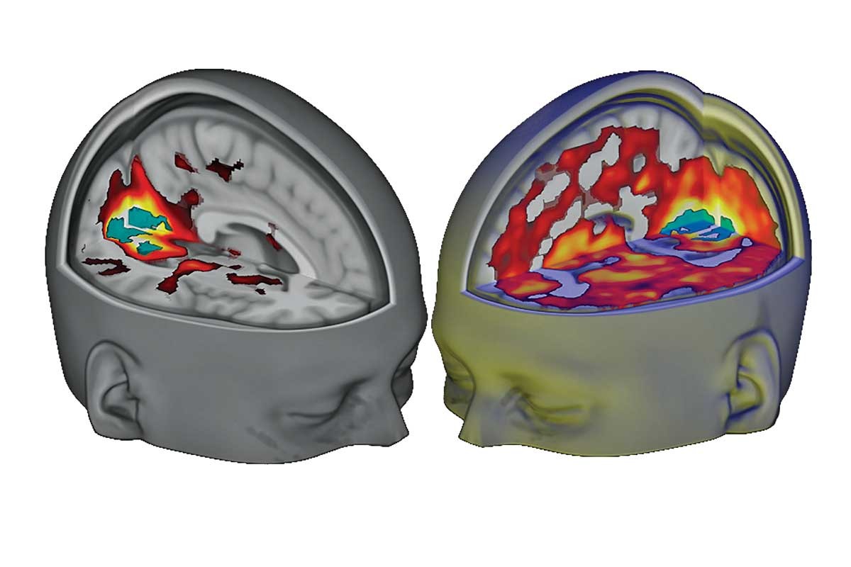 Secrets of LSD unlocked in surprising new study